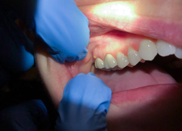  Johnston City, IL Emergency Dentist Pros