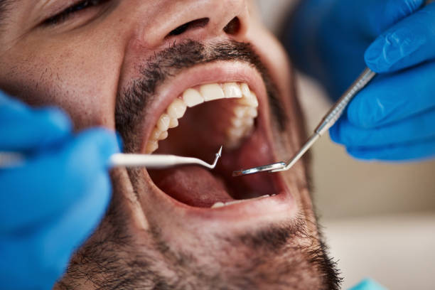 Best Knocked-Out Tooth Emergency  in Johnston City, IL